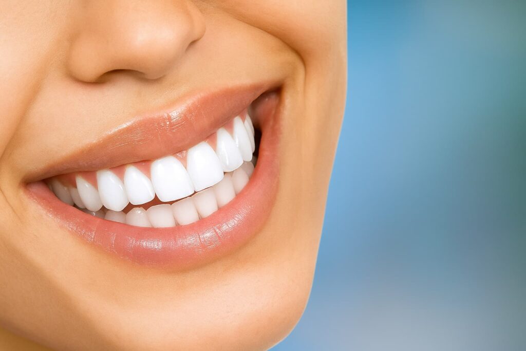 Una boca después de hacerse un blanqueamiento dental